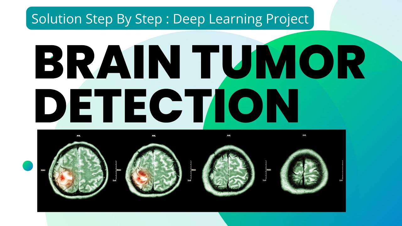 Brain Tumor Detection Using Deep Learning | Step By Step Solution | Deep Learning Project