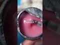 Grade Гель жидкий Liquid gel Potal 34, 15 мл