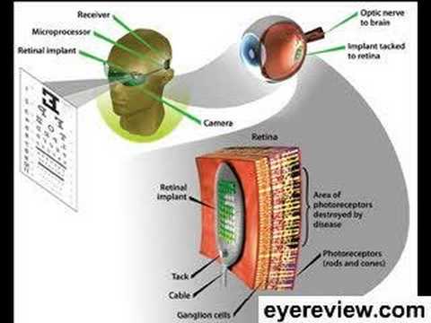 Macular Degeneration Research