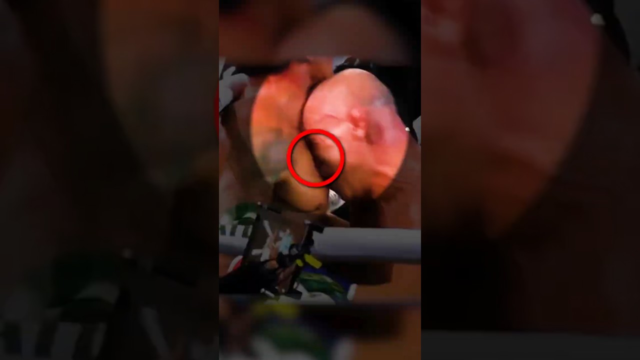 反則を犯した無礼なファイターの末路