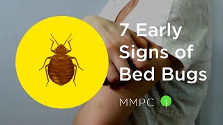 7 Early Signs of BED BUGS (How to Know if You Have Bed Bugs)