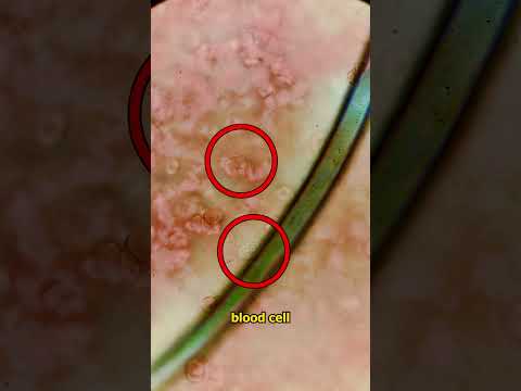 White Blood Cells VS MICROPLASTIC