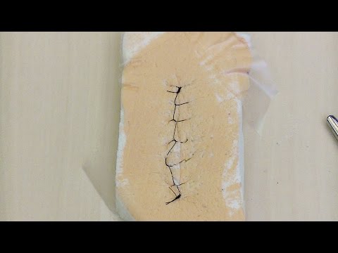 Running Locking Suture