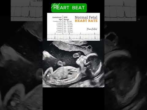 Fetal Heart Rate | Ultrasound #baby #reels #shorts