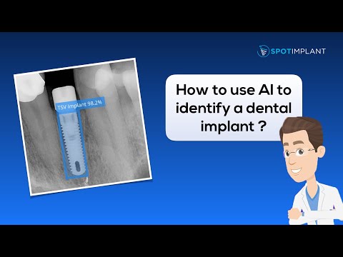 image-How do you know if you have a dental implant?
