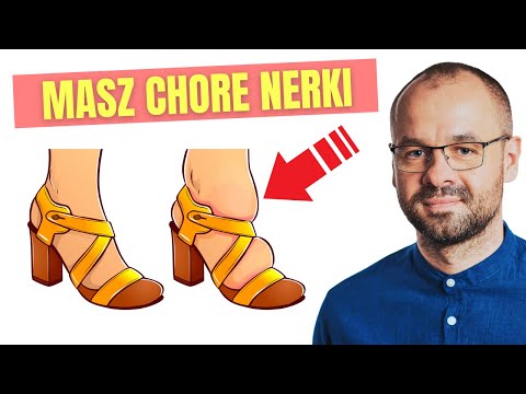 7 wczesnych objawów chorych nerek - większość z nich bagatelizujesz.