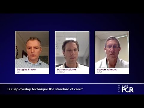 Is Cusp Overlap technique the Standard of Care?