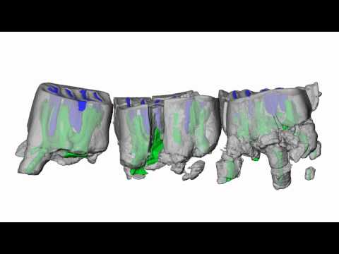 Virtual reconstruction of cranium of Vintana sertichi (V)