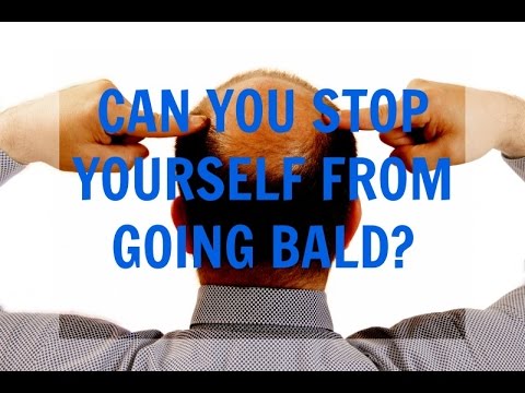 Male Pattern Baldness - Can You Stop Yourself From Going Bald?