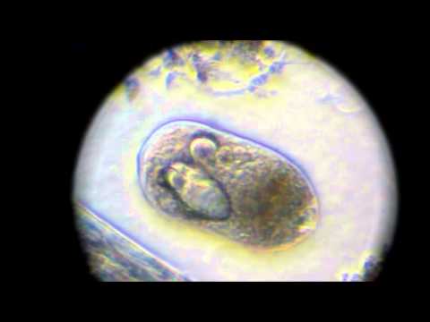 Protozoan emberi paraziták kezelése