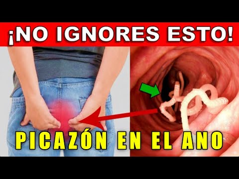 🔴🍑🔴 PICAZÓN en el ANO | COMEZÓN ANORRECTAL | ¿Cómo quitar el PICOR ANAL?