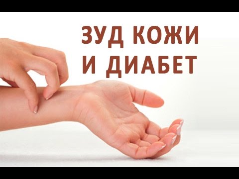 Сто веснушек на носу Маски для жирной кожи с веснушками