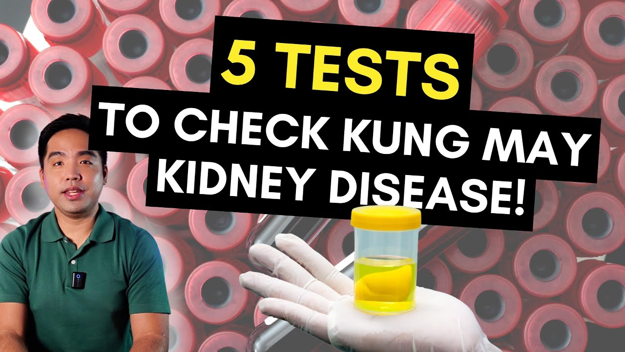 5 Tests Para Malaman Kung May Kidney Disease