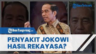 Warganet Mulai Curigai Penyakit Kulit Jokowi, Tuding Corak di Wajah Hanya Riasan Demi Buat 'Drama'