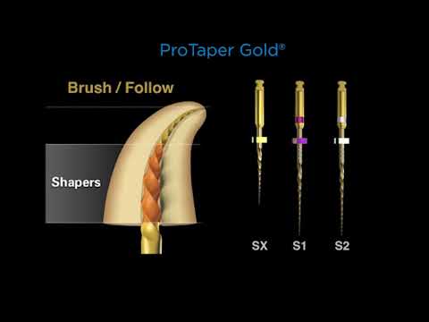 Canal preparation with ProTaper Gold® | Dentsply Sirona
