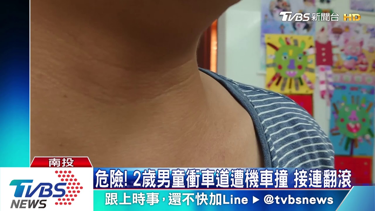 危險！2歲男童衝車道遭機車撞　接連翻滾