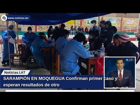 SARAMPIÓN EN MOQUEGUA: Confirman primer caso y esperan resultados de otro