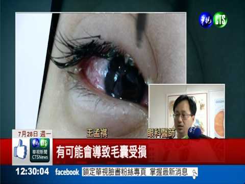 假睫毛沒洗淨 害發炎真睫毛掉光