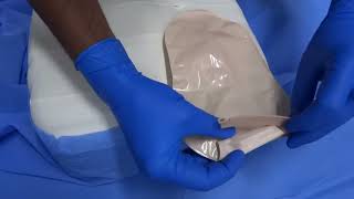 (Ostomy/Colostomy clip)How to Clamp of Ostomy/Colostomy bag to clip Complete Procedure in Hindi/Urdu