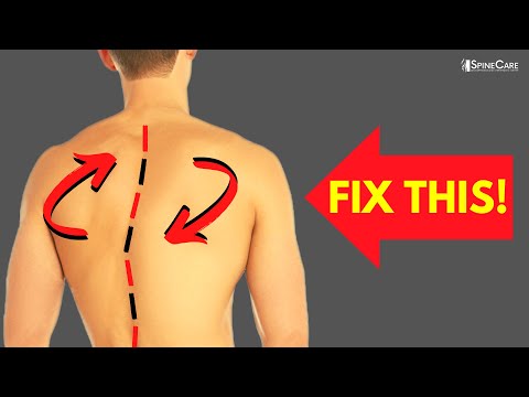 The Best Exercises For a Twisted Back