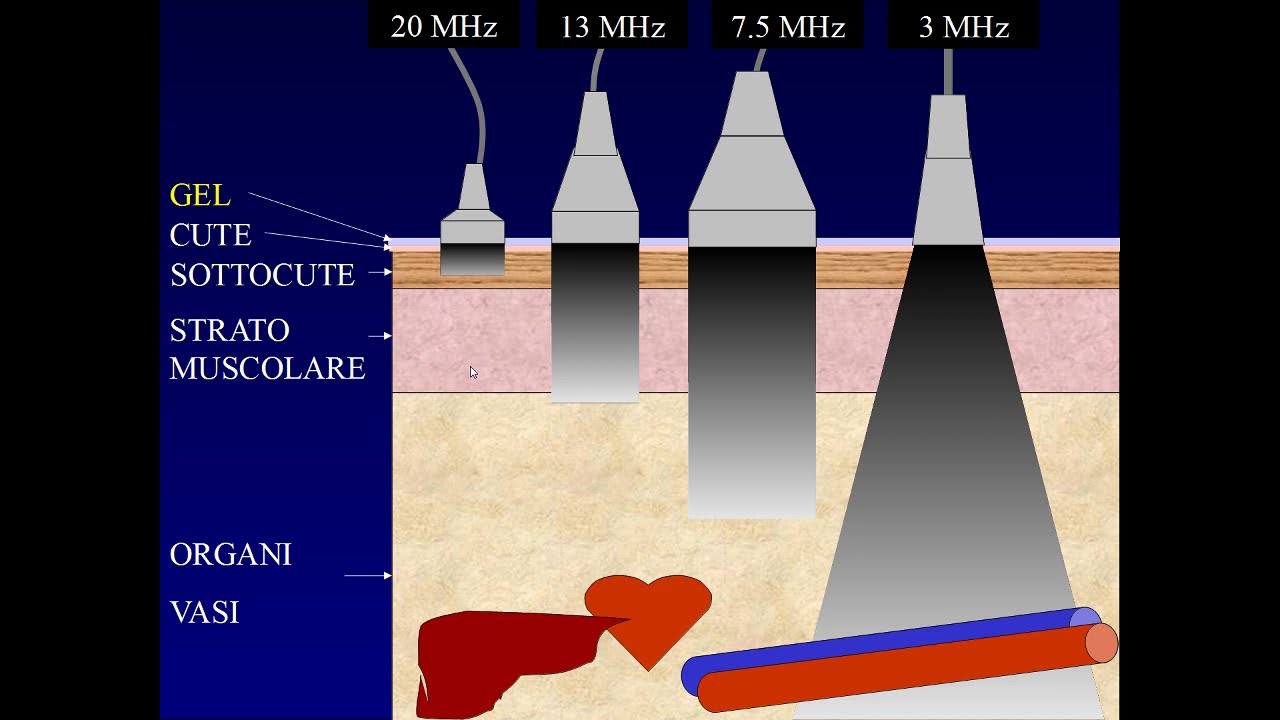 Watch Now Principi fisici degli ultrasuoni - Parte 1 Principi fisici degli ultrasuoni - Parte 1