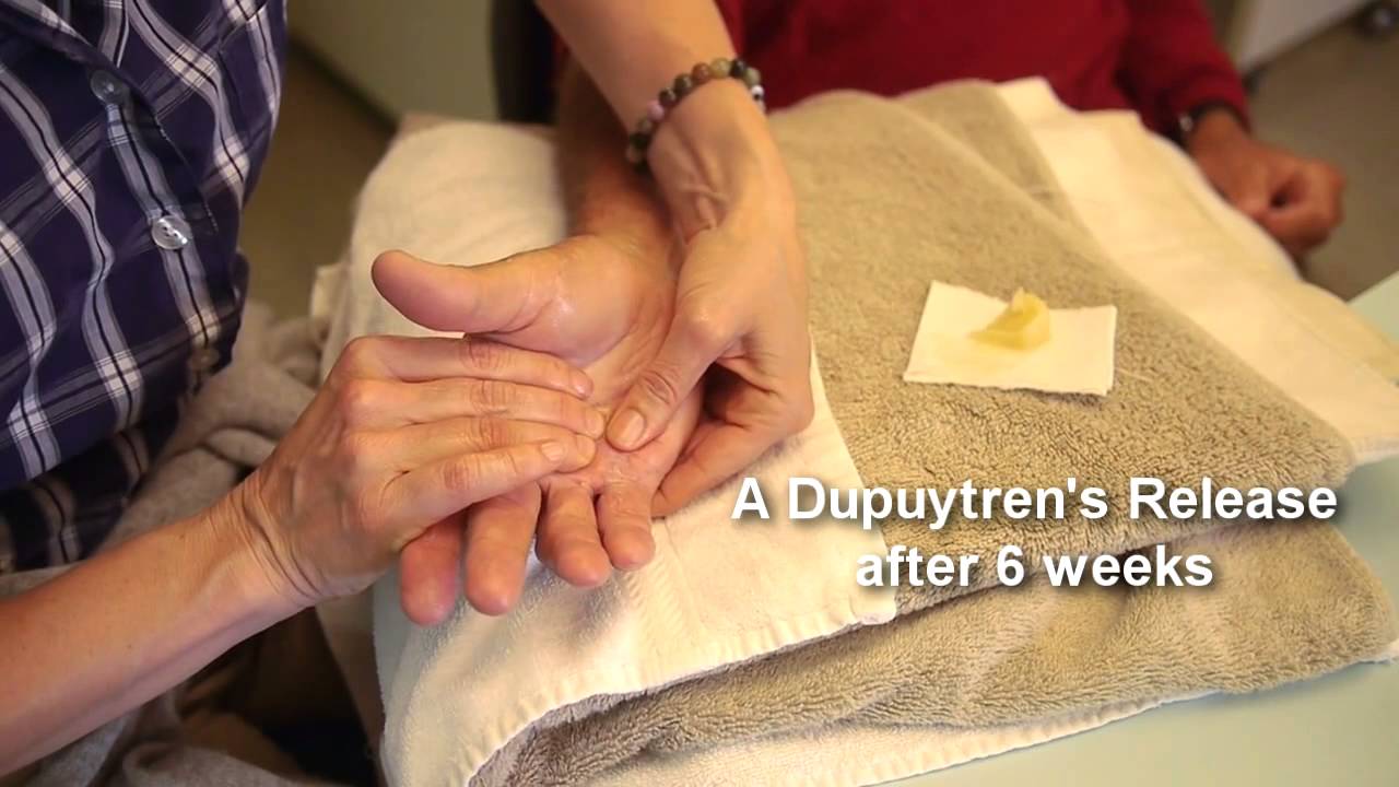 Medical: Hands of San Francisco
