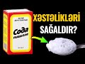 1 Qaşıq SODA Görün Hansı Xəstəlikləri Sağaldır Həkimlər Niyə Demir