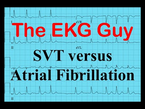 EKG/ECG - SVT vs Atrial Fibrillation | The EKG Guy - www.EKG.md