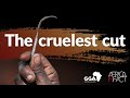 Female Genital Mutilation