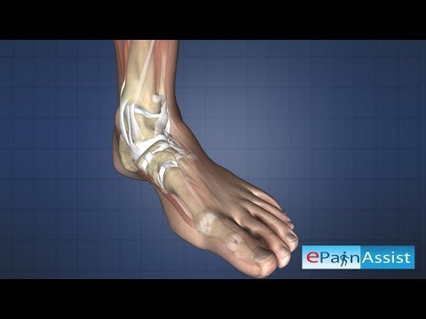 Behandlung der arteriellen Kompression des Halswirbels ÐºÐ¾Ð Ñ »Ñ ько Ñ, оиÑ, Ñ, ÐμÑ € Ð ° Ñ“ Ð »ÐμÐºÑ Ð¾Ñ, Ñ ÑƒÑ Ñ, Ð ° вов мР° Ð · NOE