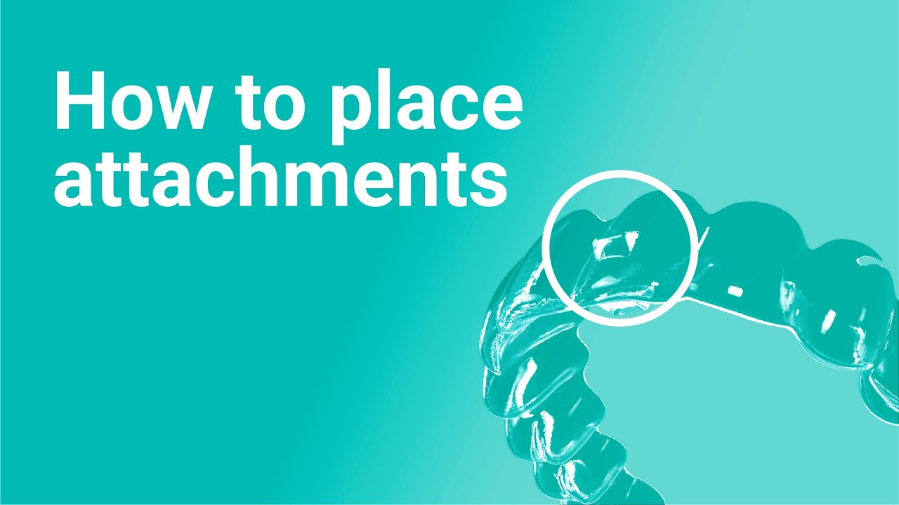 How to Place Attachments in Aligners [Avoid These Common Mistakes!]