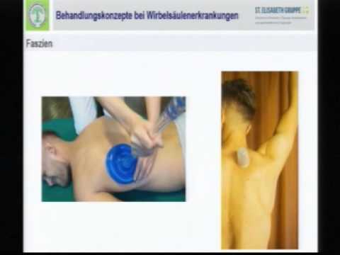 Kann es Fieber und Schüttelfrost sein Osteochondrose Auf der Hand Gelenke der Finger fallen