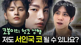 뭉특한 복코 콧볼축소하고 싶어요 | 워나 첫코성형 리얼모델