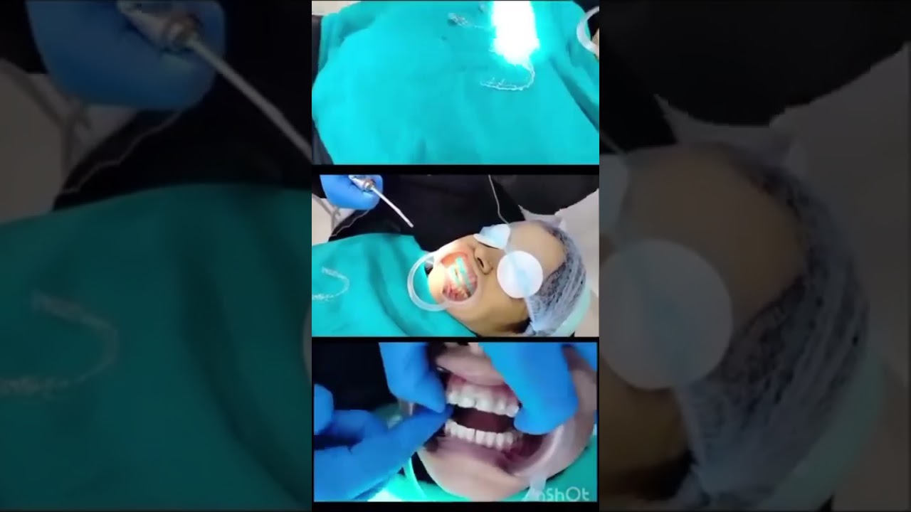 Dr. Priya Gupta # Oral surgeon # Dental Aligners # Straightening of teeth # smile # Orthodontics