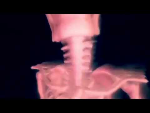 Oz Sparx - Backseat Freestyle (Official Audio) [prod. by Jahdiddat]