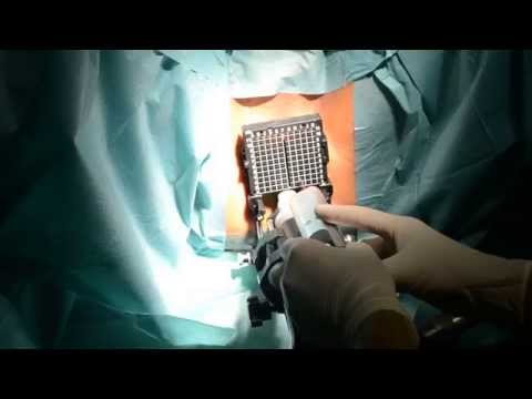 Wie Prostatitis wirkt sich auf die Leber Tannenöl von BPH