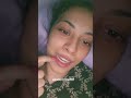 What Is A Wisdom Tooth Skyjournalswithsana Wisdomteeth Teethremoval Teeth Toothfriendly