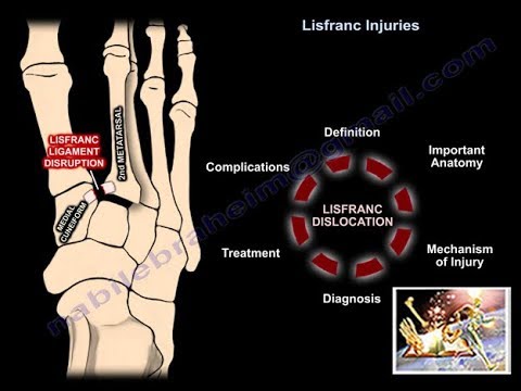 Artrita și artroza degetelor