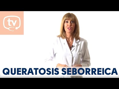 ¿Qué es la queratosis seborreica?