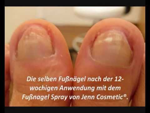 Die Salbe bei gribke zwischen der Finger der Beine Das Medikament von gribka auf den Beinen in spb