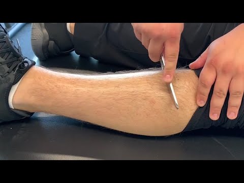 Anterior Shin Splint: Self-Treatment and Exercises! | Oak Brook Medical Group, IL