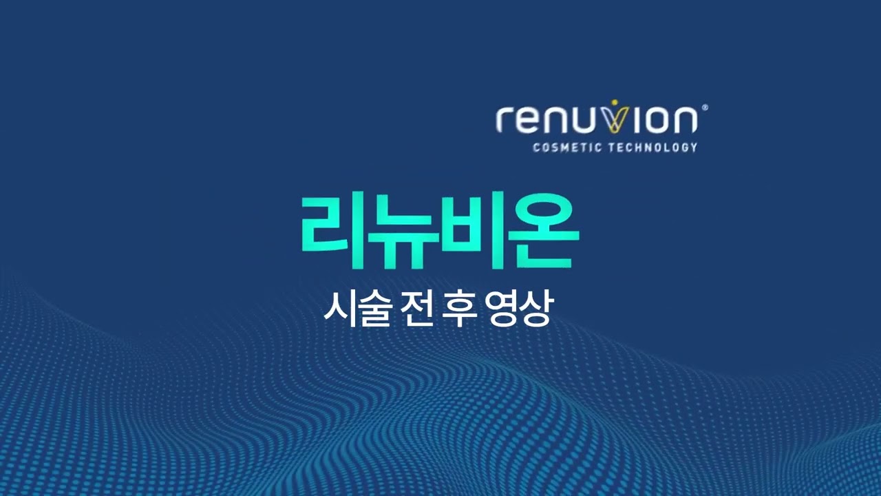 리뉴비온 시술 전후 영상 재생