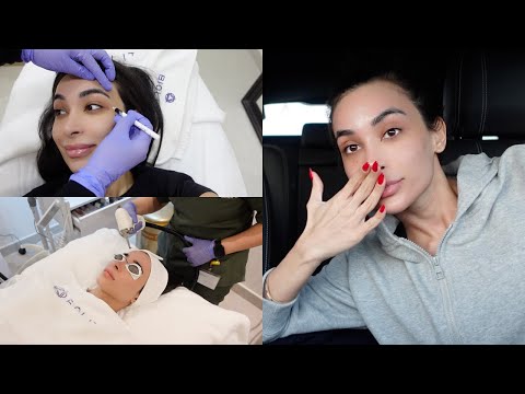 MY 1 MONTH WEDDING MAINTENANCE