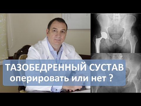 Локтевой сустав перелом наложение гипса Как укрепить коленные суставы при артрозе