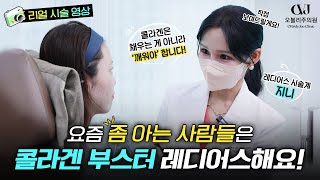 레디어스 콜라겐부스터가 다시 핫?해진 이유! 팔자주름부터 꺼진 볼, 탄력 리프팅까지 시술 영상으로 ‘진짜 효과’ 공개합니다!