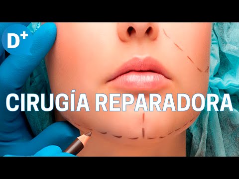 ¿Qué es la Cirugía Reparadora?