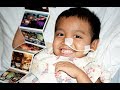 Big Help For Little Hearts UCLA Mattel Children S Hospital