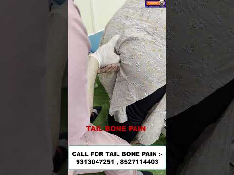 CHIROPRACTIC TREATMENT IN MUMBAI | TAIL BONE PAIN | DR. VARUN DUGGAL CHIROPRACTIC #mumbai #shortfeed