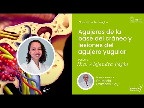 Agujeros de la base del cráneo y lesiones del agujero yugular por Dra. Alejandra Pajón.