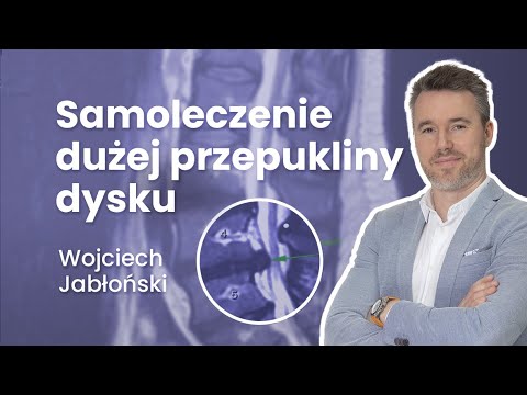 Samoleczenie dużej przepukliny dysku | #6 Radiologia kręgosłupa
